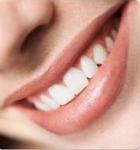 Blanqueamiento dental