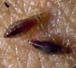 Eliminar los piojos de mi casa