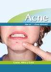 Prevenir el acne cambaindo la comida
