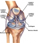 Lesión de Ligamento Cruzado Anterior de Rodilla