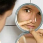 Lo Que No Debe Hacer Teniendo Acne