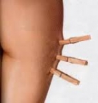 Como Perder celulitis