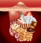 Elimina el acné para siempre y de forma natural