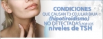Condiciones que causan el Hipotiroidismo