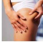 Formas para eliminar completamente la celulitis