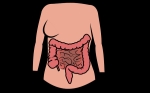 Estrategias Para Controlar Los Síntomas Del Intestino Irritable (SII)